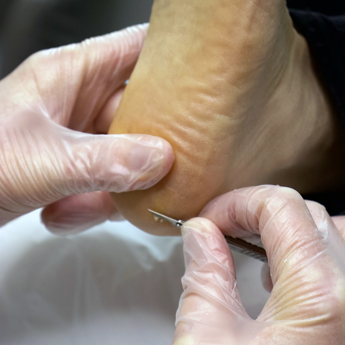 Warm, caring clinical image - hand-holding or reassuring patient moment